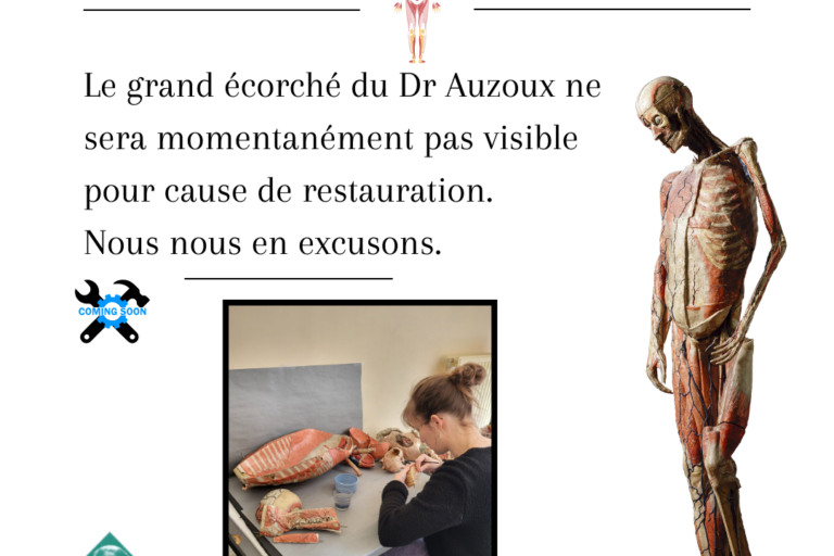 Le modèle Auzoux ne sera momentanément pas visible pour cause de restauration. Nous nous en excusons (1)